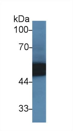 SERPINA1 / Alpha 1 Antitrypsin Antibody (aa25-413, APC)