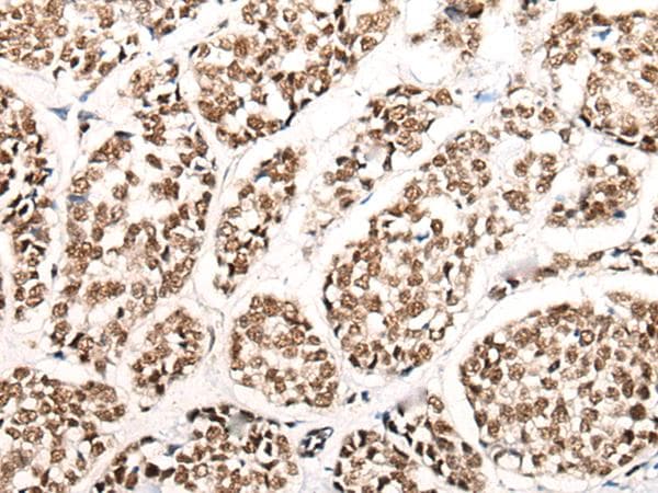 Polyclonal Rabbit anti-Human HGH1 / FAM203A Antibody (IHC)