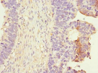 RALB Antibody