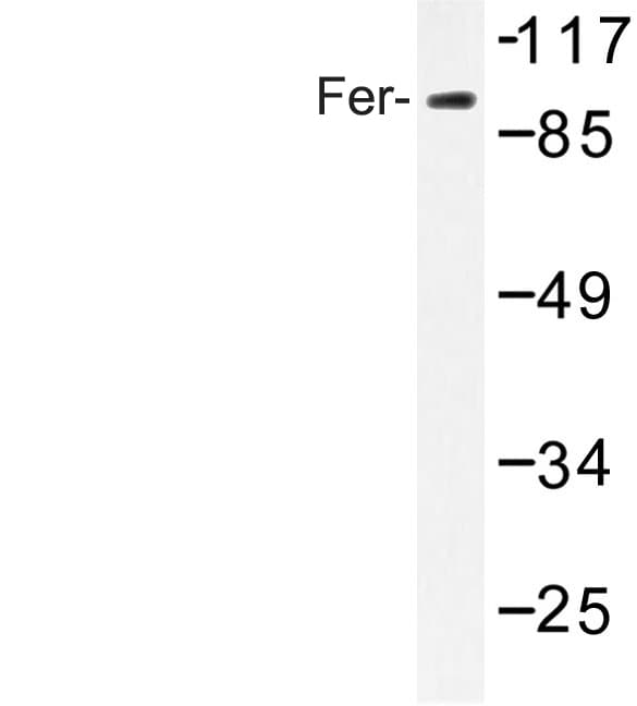FER Antibody (Asp798)