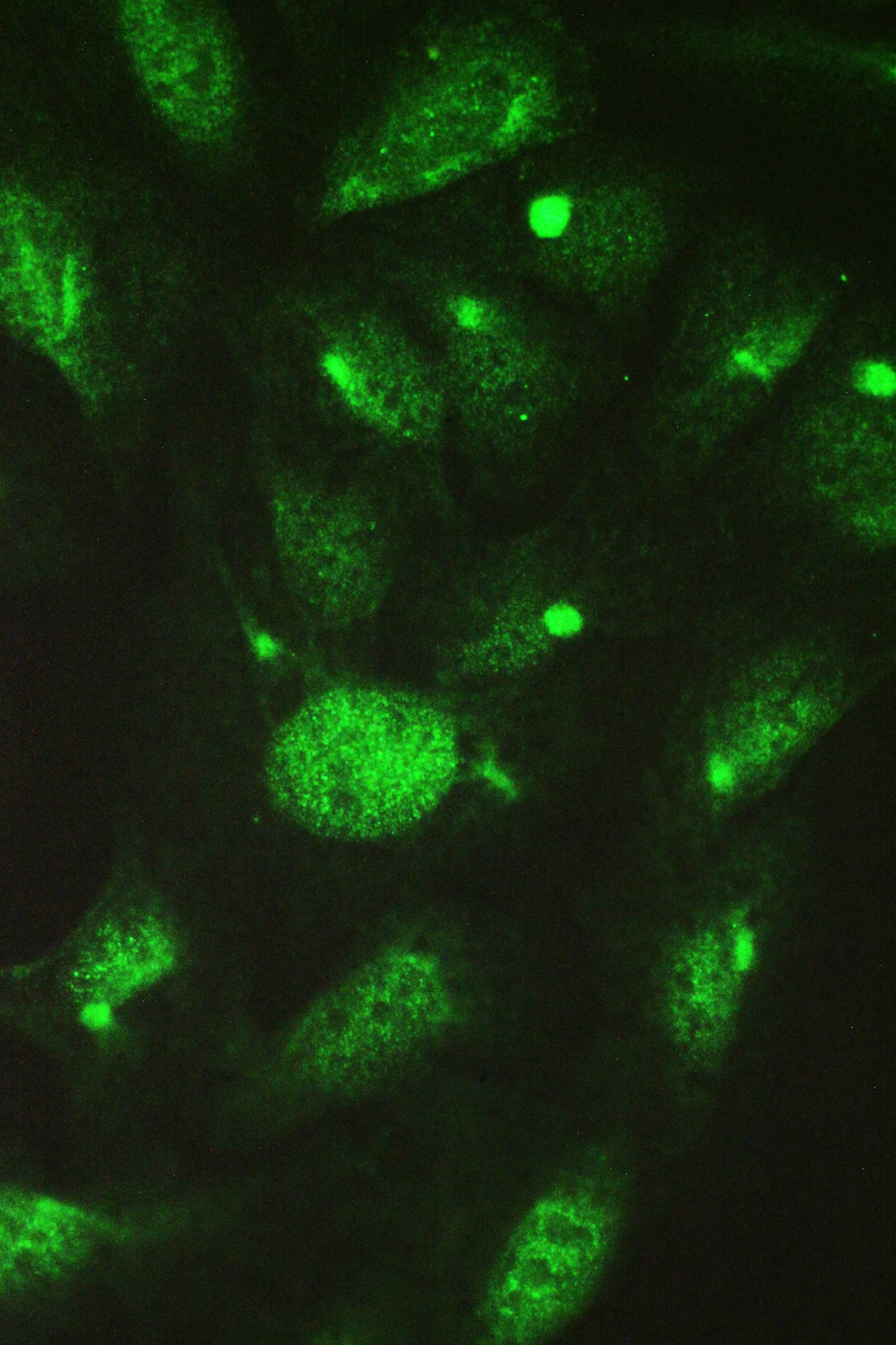 CCT4 / SRB Antibody