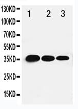 Polyclonal Rabbit anti-Human TBX21 / T-bet Antibody (aa522-535, WB)