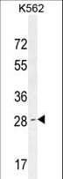 OR52D1 Antibody (aa248-277)