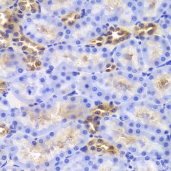 DIAPH1 Antibody