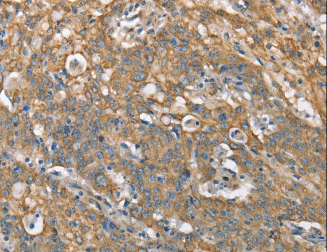 CSMD1 Antibody