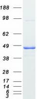 Human PRKAR1A Protein (Recombinant Myc-DDK (Flag))