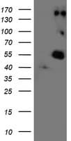 LOX / Lysyl Oxidase Antibody (clone OTI9G2)