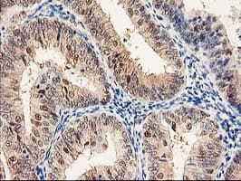 PSMB4 Antibody (clone OTI2C9)