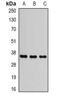 Polyclonal Rabbit anti-Human SLC25A4 / ANT Antibody (IHC, WB)