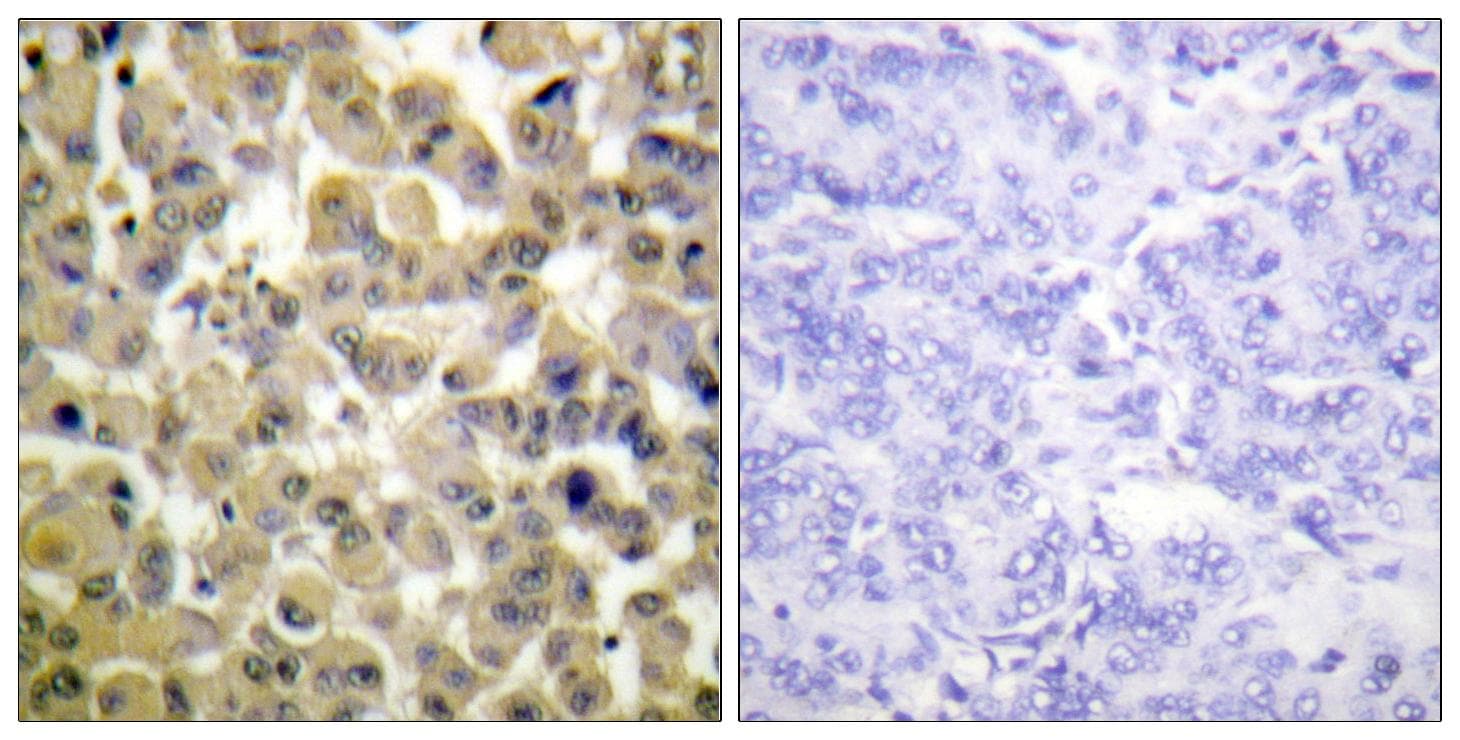 Polyclonal Rabbit anti-Human RPS6KA5 / MSK1 Antibody (phospho-Ser360, IHC, IF)