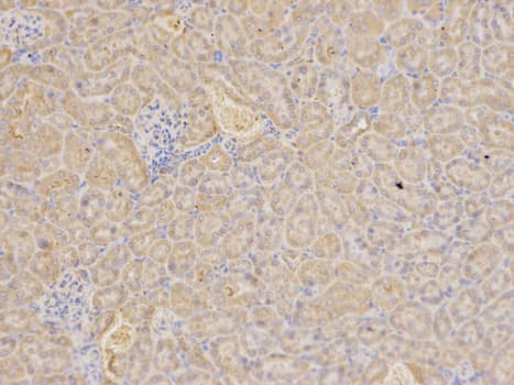 RICK / RIP2 Antibody