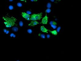 SENP2 Antibody (clone OTI1C4)