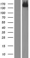 ERBB2 / HER2 Protein (Over-Expression Lysate Myc-DDK (Flag))
