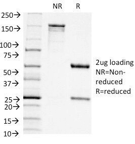 ITGAX / CD11c Antibody (aa600-850, clone ITGAX/1242)
