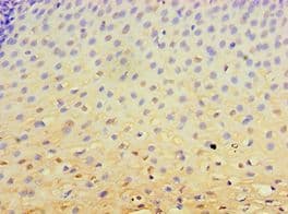 RB1 / Retinoblastoma / RB Antibody (aa649-928)