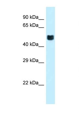 FOXO4 / AFX1 Antibody (C-Terminus)