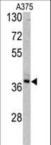 TALDO1 / Transaldolase 1 Antibody (aa186-215)