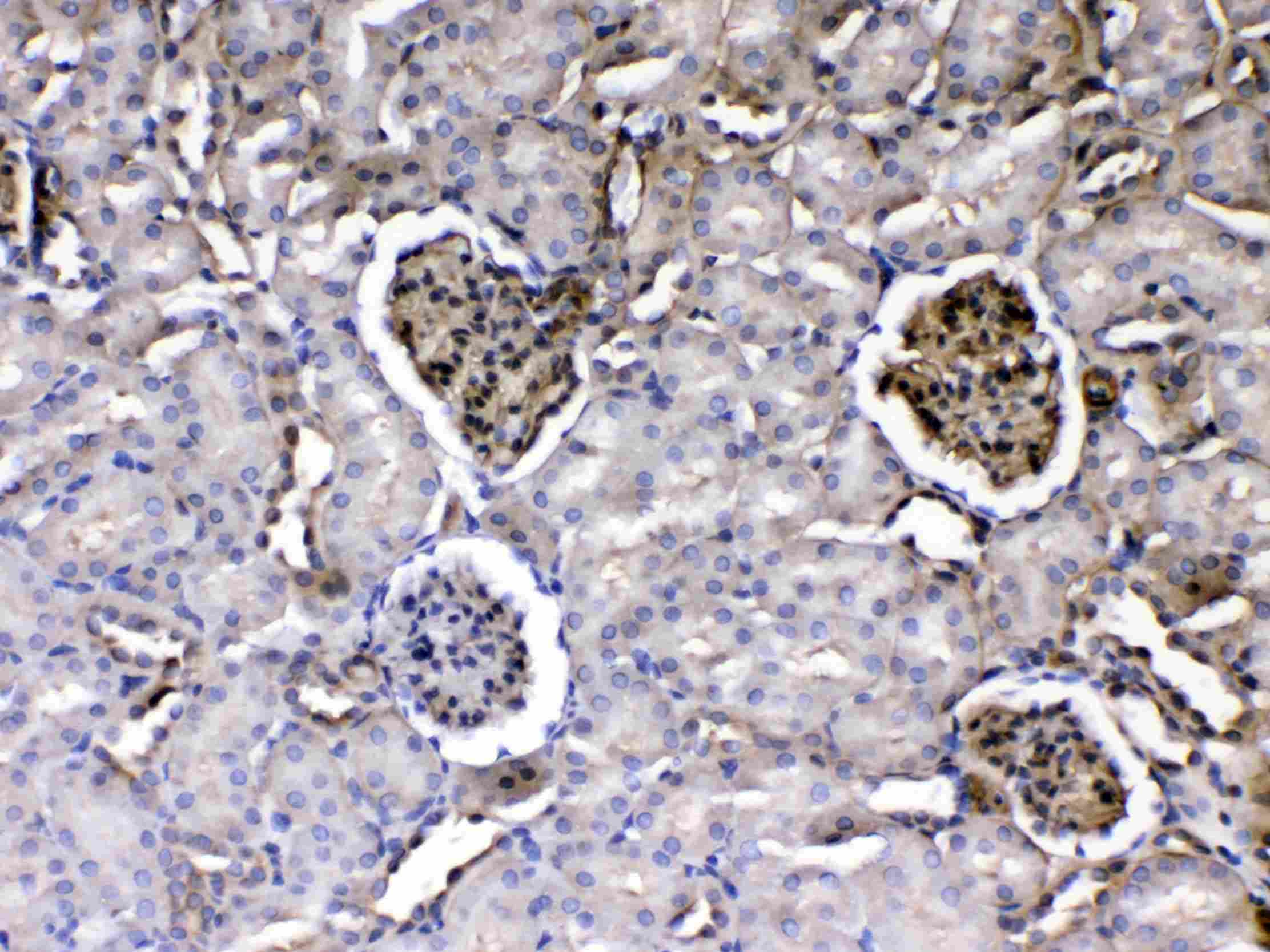 LAMC1 / Laminin Gamma 1 Antibody