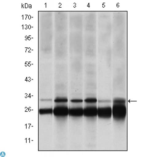 PSMB8 / LMP7 Antibody