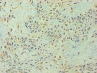 Polyclonal Rabbit anti-Human DIRAS3 / ARHI Antibody (aa1-229, IHC)