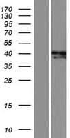 ADAL Protein (Over-Expression Lysate Myc-DDK (Flag))