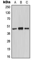 MASP1 / MASP Antibody (Internal)