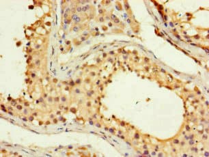 Polyclonal Rabbit anti-Human FMNL3 Antibody (IHC, IF)