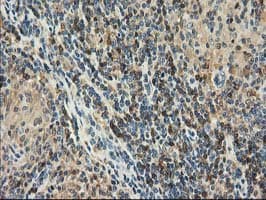 CAT / Catalase Antibody (clone OTI1B8)