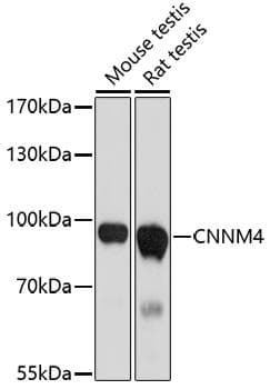 Polyclonal Rabbit anti-Human CNNM4 Antibody (WB)