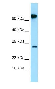 Polyclonal Rabbit anti-Human FKBP10 / FKBP65 Antibody (aa65-114, WB)