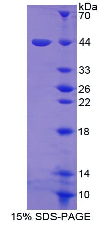 Human HSF4 Protein (Recombinant His-GST-S)