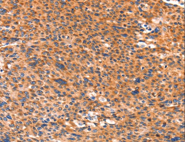 AMPD1 Antibody