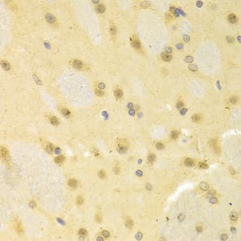 SMAD1 Antibody