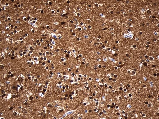 Monoclonal Mouse anti-Human UCHL1 / PGP9.5 Antibody (clone UMAB244, Carrier-free, IHC, WB)