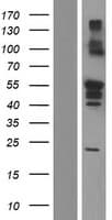 RBCK1 Protein (Over-Expression Lysate Myc-DDK (Flag))