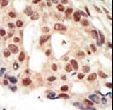 Polyclonal Rabbit anti-Human PRKG2 / CGKII Antibody (aa714-744, IHC, WB)