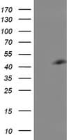 CENPH / CENP-H Antibody (clone OTI1A6)