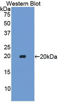 ACHE / Acetylcholinesterase Antibody (aa157-332)