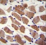 Polyclonal Rabbit anti-Human SAMD7 Antibody (aa202-230, IHC, WB)