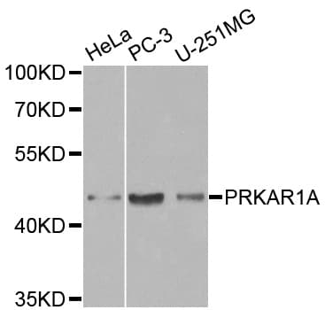 IHC-plus™ Polyclonal Rabbit anti-Human PRKAR1A Antibody (IHC, IF, WB)