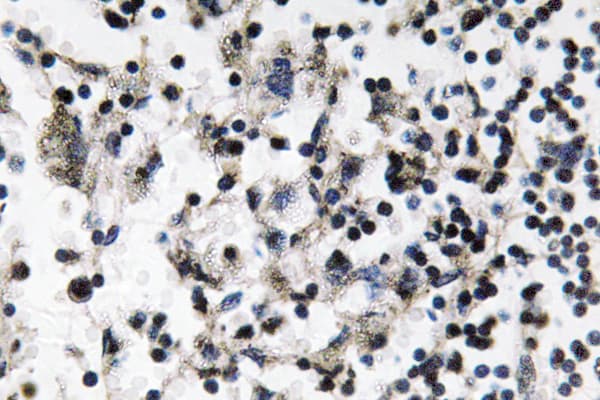 CDC37 Antibody (His9)