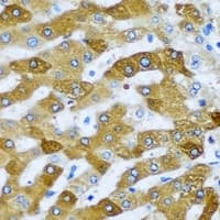 Polyclonal Rabbit anti-Human TIMM17A / TIM17 Antibody (IHC, IF, WB)