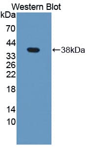 NCAN / Neurocan Antibody (aa1008-1273, PE)