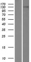 TDRD1 Protein (Over-Expression Lysate Myc-DDK (Flag))