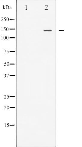 NOS3 / eNOS Antibody (phospho-Ser1177)