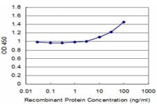 SQSTM1 Antibody (clone 1C9)