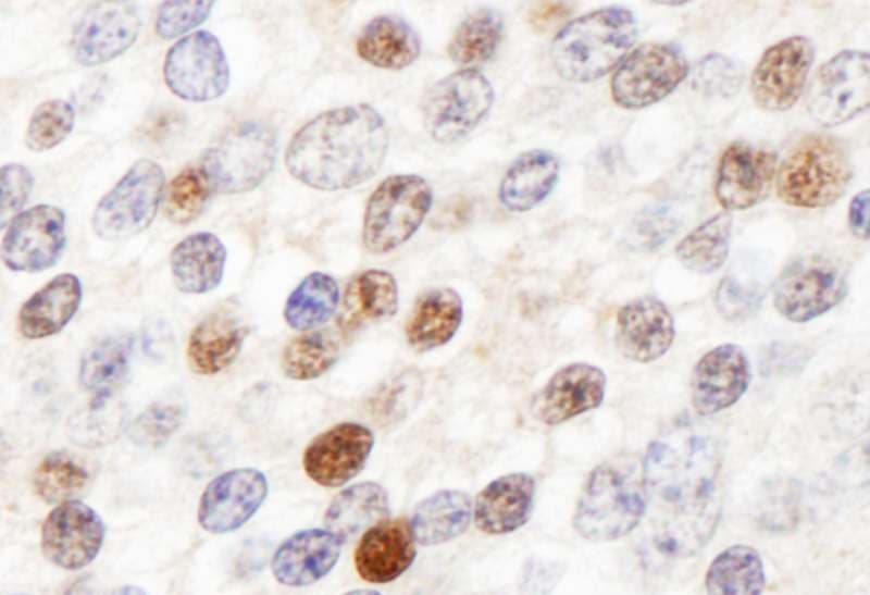 ZHX3 Antibody (aa150-200)