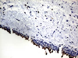 NBN / Nibrin Antibody (clone OTI3A2)