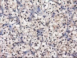 DSTN / Destrin Antibody (clone OTI2F7)