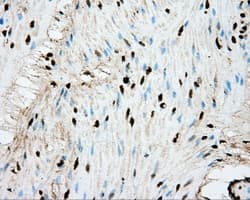 ERCC1 Antibody (clone OTI2H5)